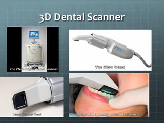 3D Dental Scanner
 