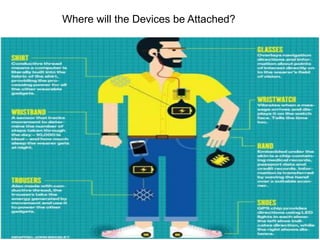 Where will the Devices be Attached?
 