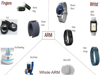 Whole ARM
 