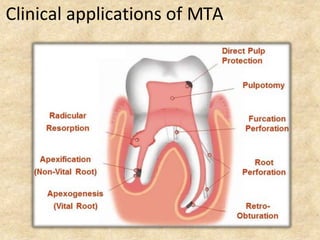 Clinical applications of MTA
 