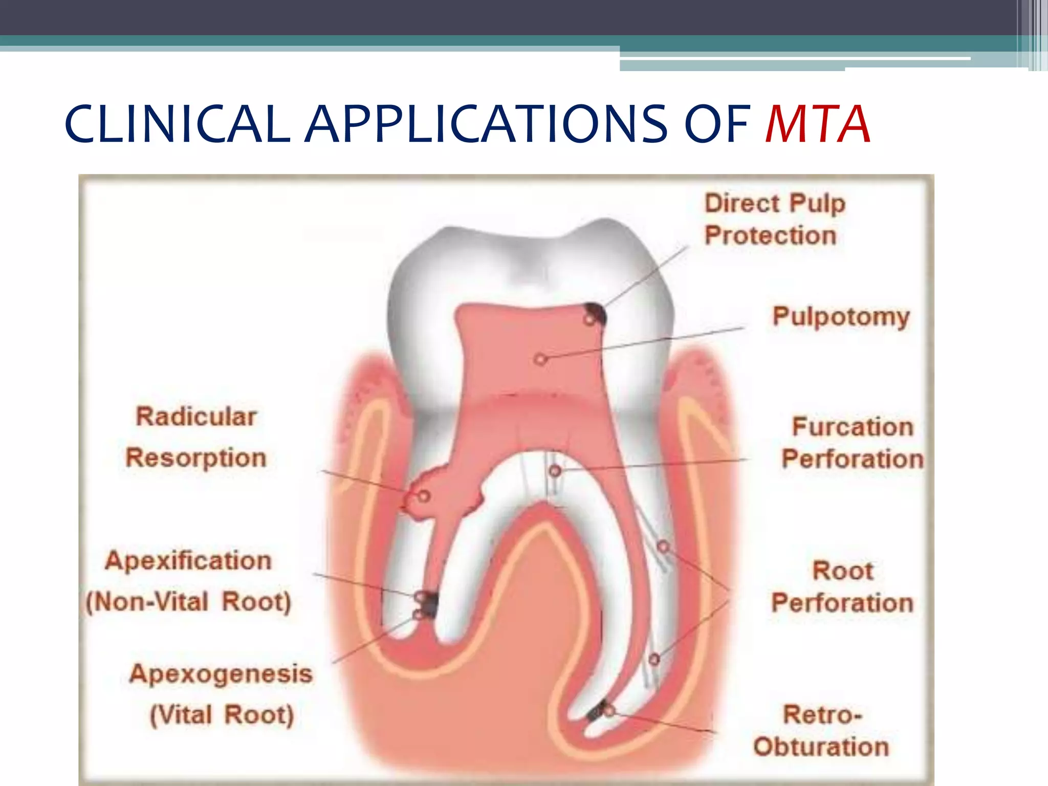 MTA & Biodentine | PPTX