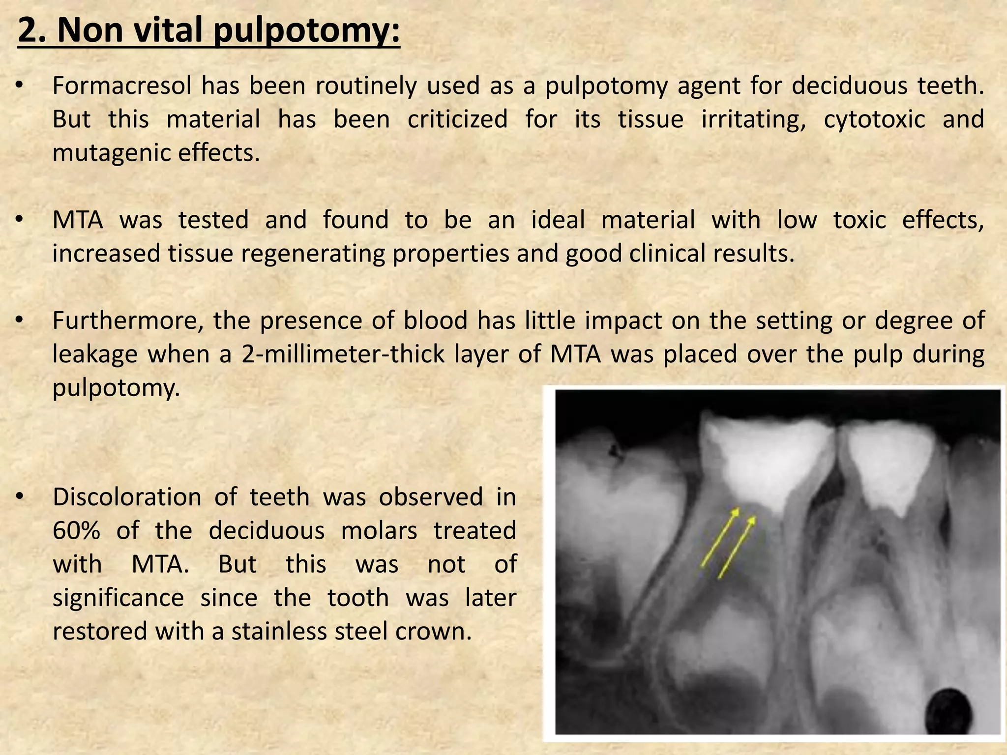 2. Non vital pulpotomy:
• Formacresol has been routinely used as a pulpotomy agent for deciduous teeth.
But this material has been criticized for its tissue irritating, cytotoxic and
mutagenic effects.
• MTA was tested and found to be an ideal material with low toxic effects,
increased tissue regenerating properties and good clinical results.
• Furthermore, the presence of blood has little impact on the setting or degree of
leakage when a 2-millimeter-thick layer of MTA was placed over the pulp during
pulpotomy.
• Discoloration of teeth was observed in
60% of the deciduous molars treated
with MTA. But this was not of
significance since the tooth was later
restored with a stainless steel crown.
 