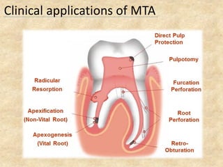 Clinical applications of MTA
 
