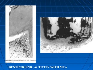 DENTINOGENIC ACTIVITY WITH MTA
 
