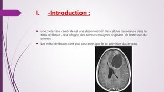 Métastase-cérébrale.pptx