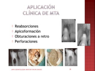    Reabsorciones
   Apicoformación
   Obturaciones a retro
   Perforaciones




UNFV ODONTOLOGIA- NESTOR TAFUR CHAVEZ   36
 