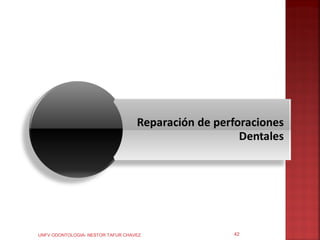 UNFV ODONTOLOGIA- NESTOR TAFUR CHAVEZ   42
 
