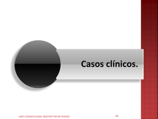 UNFV ODONTOLOGIA- NESTOR TAFUR CHAVEZ   45
 