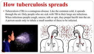 How tuberculosis spreads
 Tuberculosis (TB) is a contagious disease. Like the common cold, it spreads
through the air. Only people who are sick with TB in their lungs are infectious.
When infectious people cough, sneeze, talk or spit, they propel bacilli into the air.
A person needs only to inhale a small number of these to be infected.
16
 