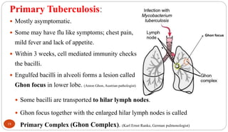Primary Tuberculosis:
 Mostly asymptomatic.
 Some may have flu like symptoms; chest pain,
mild fever and lack of appetite.
 Within 3 weeks, cell mediated immunity checks
the bacilli.
 Engulfed bacilli in alveoli forms a lesion called
Ghon focus in lower lobe. (Anton Ghon, Austrian pathologist)
19
Ghon focus
 Some bacilli are transported to hilar lymph nodes.
 Ghon focus together with the enlarged hilar lymph nodes is called
Primary Complex (Ghon Complex). (Karl Ernst Ranke, German pulmonologist)
 