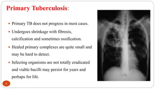 Primary Tuberculosis:
21
 Primary TB does not progress in most cases.
 Undergoes shrinkage with fibrosis,
calcification and sometimes ossification.
 Healed primary complexes are quite small and
may be hard to detect.
 Infecting organisms are not totally eradicated
and viable bacilli may persist for years and
perhaps for life.
 