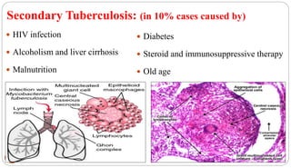 Secondary Tuberculosis: (in 10% cases caused by)
22
 Diabetes
 Steroid and immunosuppressive therapy
 Old age
 HIV infection
 Alcoholism and liver cirrhosis
 Malnutrition
 