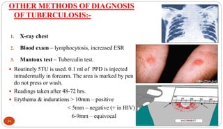 OTHER METHODS OF DIAGNOSIS
OF TUBERCULOSIS:-
1. X-ray chest
2. Blood exam – lymphocytosis, increased ESR
3. Mantoux test – Tuberculin test.
 Routinely 5TU is used. 0.1 ml of PPD is injected
intradermally in forearm. The area is marked by pen
do not press or wash.
 Readings taken after 48-72 hrs.
 Erythema & indurations > 10mm – positive
< 5mm – negative (+ in HIV)
6-9mm – equivocal
34
 