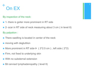 +

7

On EX

By inspection of the neck:


1- there is goiter more prominent in RT side



2- scar in RT side of neck mea...
