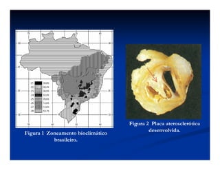 Figura 1 Zoneamento bioclimático
brasileiro.
Figura 2 Placa aterosclerótica
desenvolvida.
 