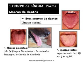 •‫ﻡ‬ Sem marcas de dentesSem marcas de dentes
Língua normalLíngua normal
•‫ﻡ‬ Marcas discretas:Marcas discretas:
↓↓ de Qi (língua flácia toma o formato dosde Qi (língua flácia toma o formato dos
dentes) ou acúmulo de umidadedentes) ou acúmulo de umidade
•‫ﻡ‬ Marcas fortes:Marcas fortes:
Agravamento da ↓ QiAgravamento da ↓ Qi
ou ↓ Yang BPou ↓ Yang BP
1 CORPO da LÍNGUA: Forma1 CORPO da LÍNGUA: Forma
Marcas de dentesMarcas de dentes
marciascognamillo@yahoo.com.br
 