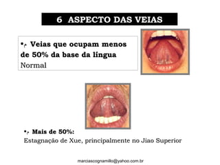 6 ASPECTO DAS VEIAS6 ASPECTO DAS VEIAS
•‫ﻡ‬ Veias que ocupam menosVeias que ocupam menos
de 50% da base da línguade 50% da base da língua
NormalNormal
•‫ﻡ‬ Mais de 50%:Mais de 50%:
Estagnação de Xue, principalmente no Jiao SuperiorEstagnação de Xue, principalmente no Jiao Superior
marciascognamillo@yahoo.com.br
 