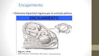 Encajamiento
• Diámetro biparietal ingresa por la entrada pélvica
 