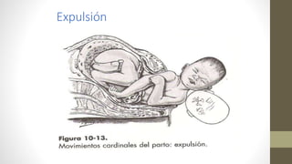 Expulsión
 