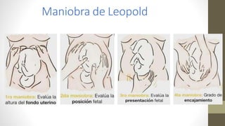 Maniobra de Leopold
 