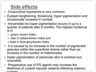 Side effects
 Conjunctival hyperemia is very common.
 Eyelash lengthening, thickening, hyper pigmentation and
occasionally increase in number.
 Irreversible iris hyper pigmentation occurs in up to a
quarter of patients after 6 months. The highest incidence
is in
 green–brown irides,
 less in yellow-brown irides and
 least in blue-grey/brown irides.
 It is caused by an increase in the number of pigmented
granules within the superficial stroma rather than an
increase in the number of melanocytes
 Hyper pigmentation of periocular skin is common but
reversible.
 Preoperative use of PG agents may increase the
likelihood of cystoid macular oedema following cataract
 