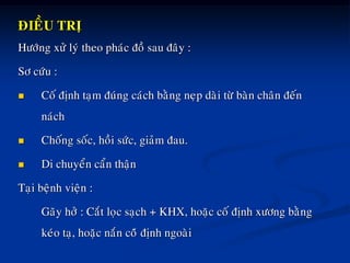ÑIEÀU TRÒ
Höôùng xöû lyù theo phaùc ñoà sau ñaây :
Sô cöùu :
 Coá ñònh taïm ñuùng caùch baèng neïp daøi töø baøn chaân ñeán
naùch
 Choáng soác, hoài söùc, giaûm ñau.
 Di chuyeån caån thaän
Taïi beänh vieän :
Gaõy hôû : Caét loïc saïch + KHX, hoaëc coá ñònh xöông baèng
keùo taï, hoaëc naén coâù ñònh ngoaøi
 
