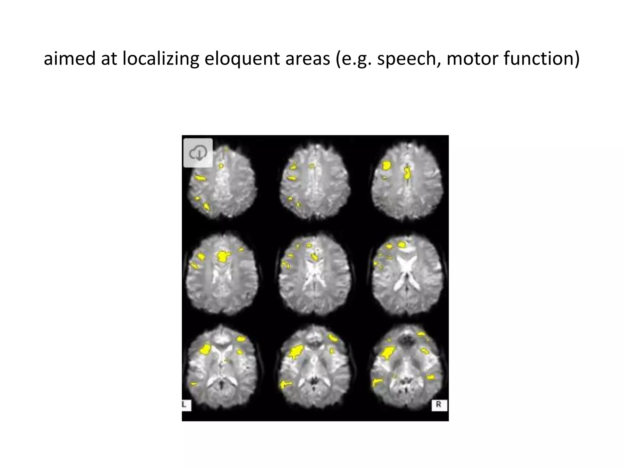 aimed at localizing eloquent areas (e.g. speech, motor function)
 