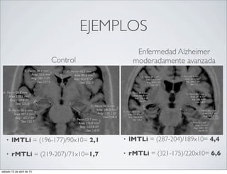 EJEMPLOS
                                                Enfermedad Alzheimer
                           Control             moderadamente avanzada




   •   lMTLi = (196-177)/90x10= 2,1       •   lMTLi = (287-204)/189x10= 4,4

   •   rMTLi = (219-207)/71x10=1,7        •   rMTLi = (321-175)/220x10= 6,6

sábado 13 de abril de 13
 