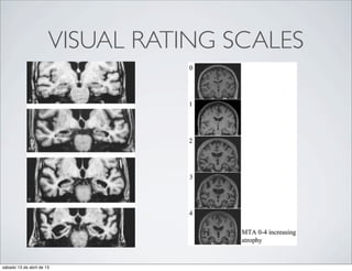 VISUAL RATING SCALES




sábado 13 de abril de 13
 