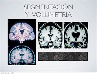 SEGMENTACIÓN
                           Y VOLUMETRÍA




sábado 13 de abril de 13
 