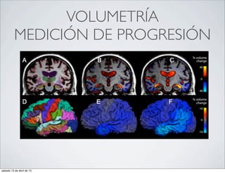 VOLUMETRÍA
          MEDICIÓN DE PROGRESIÓN




sábado 13 de abril de 13
 