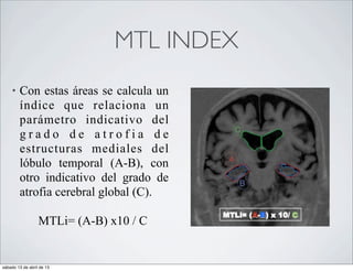 MTL INDEX
    •   Con estas áreas se calcula un
        índice que relaciona un
        parámetro indicativo del
        grado de atrofia de
        estructuras mediales del
        lóbulo temporal (A-B), con
        otro indicativo del grado de
        atrofia cerebral global (C).

                  MTLi= (A-B) x10 / C


sábado 13 de abril de 13
 