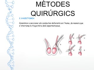 MÈTODES
QUIRÚRGICS2.VASECTOMIA
Consisteix a seccionar els conductes deferents en l'home, de manera que
s'interromp la trajectòria dels espermatozous.
 