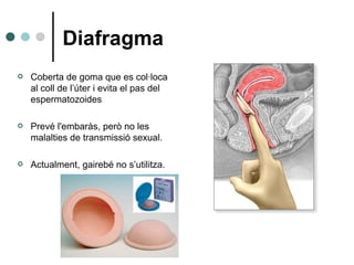 Diafragma Coberta de goma que es col·loca al coll de l’úter i evita el pas del espermatozoides Prevé l'embaràs, però no les malalties de transmissió sexual. Actualment, gairebé no s’utilitza.  