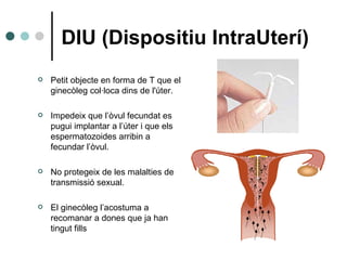 DIU (Dispositiu IntraUterí) Petit objecte en forma de T que el ginecòleg col·loca dins de l'úter. Impedeix que l’òvul fecundat es pugui implantar a l’úter i que els espermatozoides arribin a fecundar l’òvul. No protegeix de les malalties de transmissió sexual. El ginecòleg l’acostuma a recomanar a dones que ja han tingut fills 