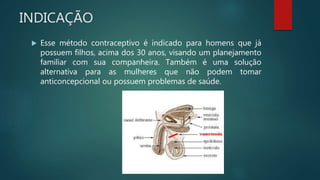 INDICAÇÃO
 Esse método contraceptivo é indicado para homens que já
possuem filhos, acima dos 30 anos, visando um planejamento
familiar com sua companheira. Também é uma solução
alternativa para as mulheres que não podem tomar
anticoncepcional ou possuem problemas de saúde.
 