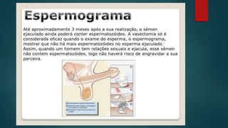 Método contraceptivo