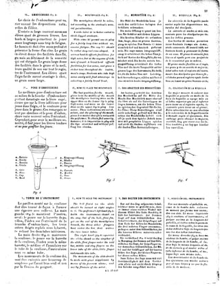 Método de trombone lafosse | PDF
