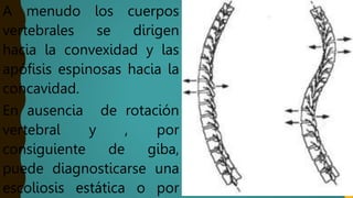 A menudo los cuerpos
vertebrales se dirigen
hacia la convexidad y las
apófisis espinosas hacia la
concavidad.
En ausencia de rotación
vertebral y , por
consiguiente de giba,
puede diagnosticarse una
escoliosis estática o por
 