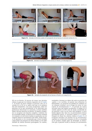 Método McKenzie: diagnóstico y terapia mecánica de la columna vertebral y las extremidades ¶ E – 26-076-A-10

Figura 14. Ejemplos de técnicas usadas en la progresión de las fuerzas en extensión lumbar (A a F).

Figura 15. Ejemplos de progresión de las fuerzas en ﬂexión y en descarga (A, B).

Figura 16. Ejemplos de progresión de las fuerzas en ﬂexión y en carga (A a C).

PD era en flexión. El proceso de tomar una decisión
clínica se guía por los criterios expuestos en el Cuadro
V. El hecho de hacer trabajar al paciente sólo en el
sentido de su PD no se aplica más que en la primera
fase del tratamiento. Con raras excepciones, todos los
pacientes en los que inicialmente se ha observado una
preferencia direccional en extensión, al final también
deben efectuar ejercicios en flexión. El objetivo terapéutico es recuperar una función completa e indolora. En
las actividades diarias, la flexión de la columna vertebral
en conjunto y la del sector lumbar en particular son sin
ninguna duda los movimientos más útiles. Desde luego,
a los pacientes se les recomienda que eviten levantar
cargas desde una posición de cifosis lumbar y se les debe
disuadir de realizar flexiones prolongadas. En cambio,
Kinesiterapia - Medicina física

enseñarles a levantar un objeto del suelo en posición de
«galán» o en cuclillas, no puede sino alimentar la
kinesiofobia y la sensación de pérdida de confianza en
su columna vertebral, con el riesgo de entrar en una
espiral de desadaptación [56] . El período de espera
necesario para que pueda incorporarse el trabajo en el
sentido opuesto a la PD varía de modo considerable de
un paciente a otro: en los casos más benignos, a veces
bastan algunos días. Rara vez, en presentaciones clínicas
inicialmente graves, es necesario esperar 2 o 3 meses.
Después de reunir los criterios clínicos (Cuadro V), el
terapeuta introduce las pruebas de los movimientos
repetidos en la dirección contraria a la PD y, si la prueba
ya no produce ningún signo de desarreglo, la instrucción que el paciente recibe es efectuar los movimientos

11

 