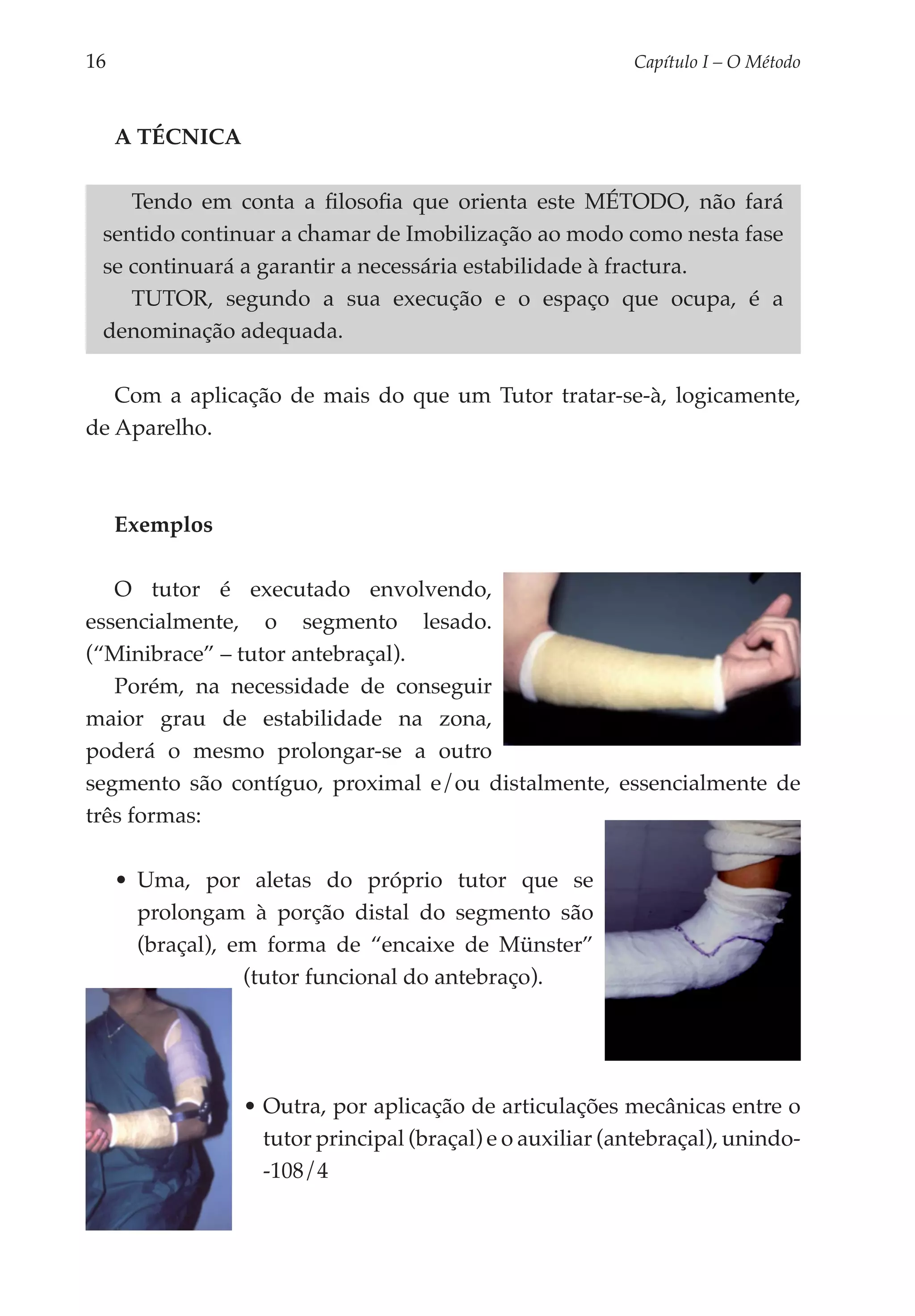 16	                                                         Capítulo I – O Método



      A Técnica

     Tendo em conta a filosofia que orienta este Método, não fará
  sentido continuar a chamar de Imobilização ao modo como nesta fase
  se continuará a garantir a necessária estabilidade à fractura.
     TUTOR, segundo a sua execução e o espaço que ocupa, é a
  denominação adequada.

   Com a aplicação de mais do que um Tutor tratar-se-à, logicamente,
de Aparelho.



      Exemplos

   O tutor é executado envolvendo,
essencialmente, o segmento lesado.
(“Minibrace” – tutor antebraçal).
   Porém, na necessidade de conseguir
maior grau de estabilidade na zona,
poderá o mesmo prolongar-se a outro
segmento são contíguo, proximal e/ou distal­ ente, essencialmente de
                                           m
três formas:

      •	 Uma, por aletas do próprio tutor que se
         prolongam à porção distal do segmento são
         (braçal), em forma de “encaixe de Münster”
                    (tutor funcional do antebraço).




                  •	Outra, por aplicação de articulações mecânicas entre o
                    tutor principal (braçal) e o auxiliar (antebraçal), unindo-
                    -108/4
 