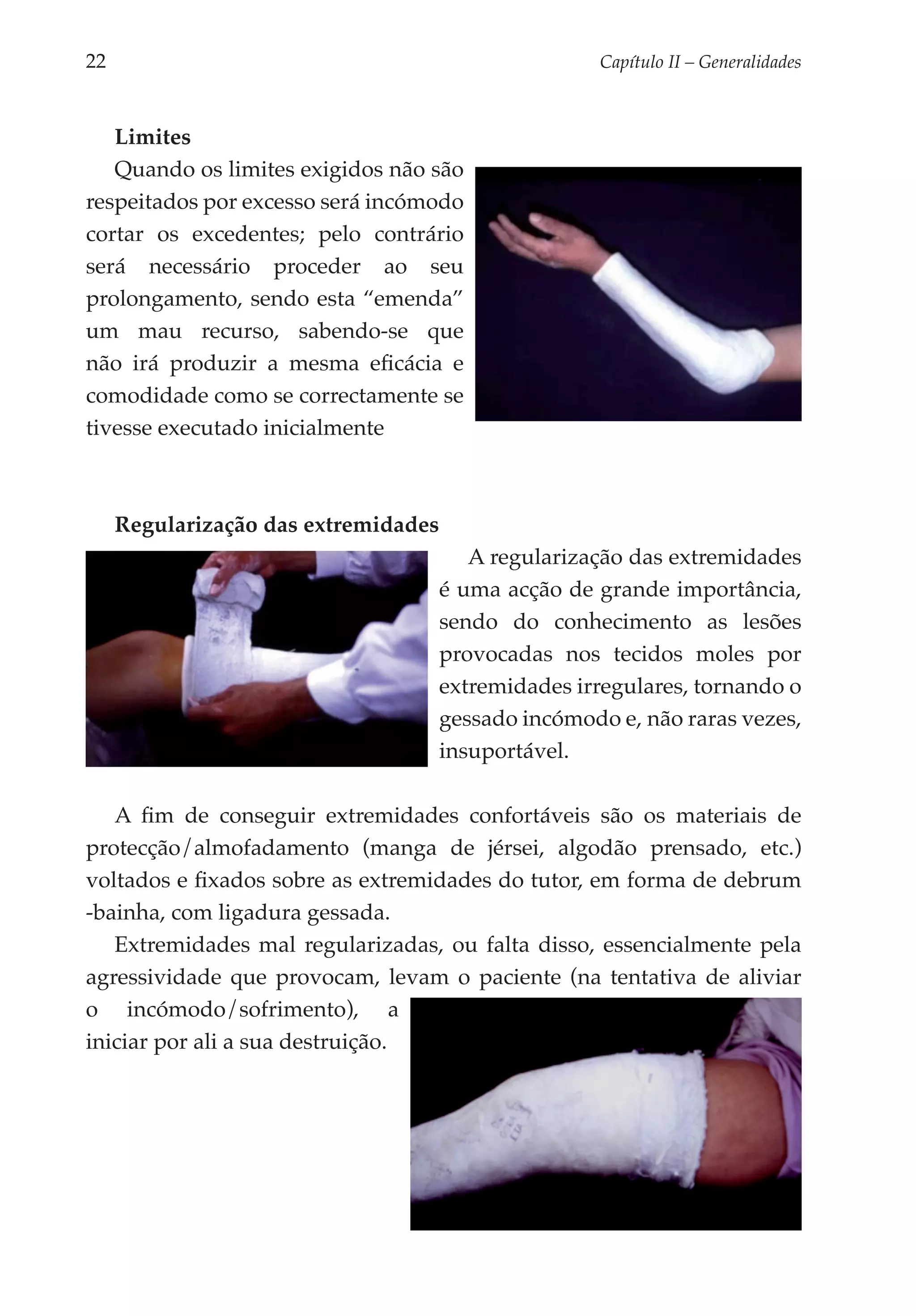22	                                                   Capítulo II – Generalidades



   Limites
   Quando os limites exigidos não são
respeitados por excesso será incómodo
cortar os excedentes; pelo contrário
será necessário proceder ao seu
prolongamento, sendo esta “emenda”
um mau recurso, sabendo-se que
não irá produzir a mesma eficácia e
comodidade como se correctamente se
tivesse executado inicialmente



      Regularização das extremidades
                                          A regularização das extremidades
                                       é uma acção de grande importância,
                                       sendo do conhecimento as lesões
                                       provocadas nos tecidos moles por
                                       extremidades irregulares, tornando o
                                       gessado incómodo e, não raras vezes,
                                       insuportável.

   A fim de conseguir extremidades confortáveis são os materiais de
protecção/almofadamento (manga de jérsei, algodão prensado, etc.)
voltados e fixados sobre as extremidades do tutor, em forma de debrum
-bainha, com ligadura gessada.
   Extremidades mal regularizadas, ou falta disso, essencialmente pela
agressividade que provocam, levam o paciente (na tentativa de aliviar
o incó­ odo/sofrimento), a
         m
iniciar por ali a sua destruição.
 