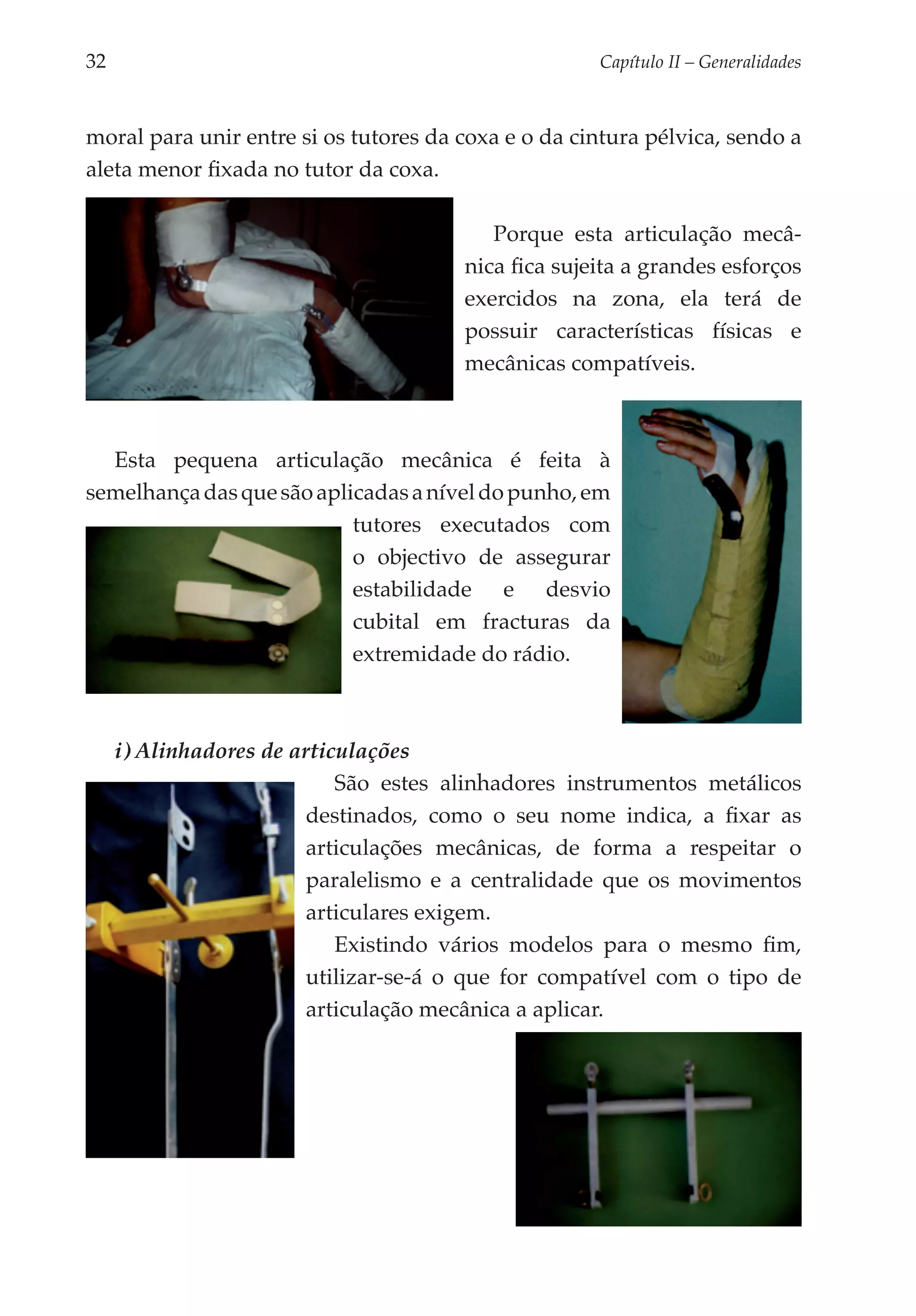 32	                                                   Capítulo II – Generalidades



moral para unir entre si os tutores da coxa e o da cintura pélvica, sendo a
aleta menor fixada no tutor da coxa.

                                           Porque esta articulação mecâ­
                                        nica fica sujeita a grandes esforços
                                        exercidos na zona, ela terá de
                                        possuir características físicas e
                                        mecânicas compatíveis.



  Esta pequena articulação mecâ­ ica é feita à
                                       n
semelhança das que são aplica­ as a nível do punho, em
                             d
                           tutores executados com
                           o objectivo de assegurar
                           estabilidade e desvio
                           cubital em fracturas da
                           extremidade do rádio.



      i) Alinhadores de articulações
                             São estes alinhadores instrumentos metálicos
                          destinados, como o seu nome indica, a fixar as
                          articulações mecânicas, de forma a respeitar o
                          paralelismo e a centralidade que os movimentos
                          articulares exigem.
                             Existindo vários modelos para o mesmo fim,
                          utilizar-se-á o que for compatível com o tipo de
                          articula­ ão mecânica a aplicar.
                                   ç
 