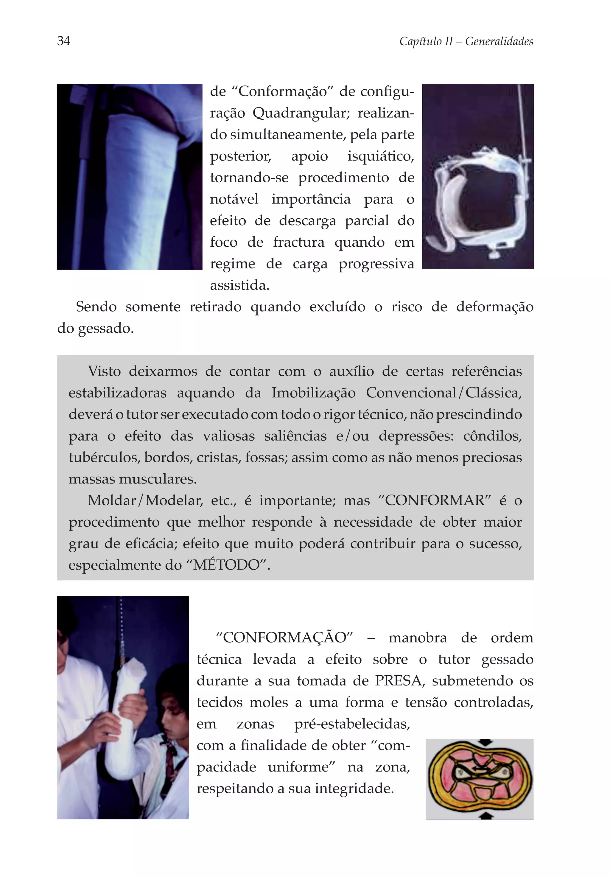 34	                                                  Capítulo II – Generalidades



                     de “Conformação” de configu­
                     ração Quadrangular; reali­ an­
                                                 z
                     do simulta­ ea­ ente, pela parte
                                n m
                     poste­ ior, apoio isquiático,
                           r
                     tornando-se proce­ imento de
                                        d
                     notável importância para o
                     efeito de descarga parcial do
                     foco de fractura quando em
                     regi­ e de carga progressiva
                         m
                     assistida.
   Sendo somente retirado quando excluído o risco de deformação
do gessado.

     Visto deixarmos de contar com o auxílio de certas referências
  estabilizadoras aquando da Imobilização Convencional/Clássica,
  deverá o tutor ser executado com todo o rigor técnico, não prescindindo
  para o efeito das valiosas saliências e/ou depressões: côndilos,
  tubérculos, bordos, cristas, fossas; assim como as não menos preciosas
  massas musculares.
     Moldar/Modelar, etc., é importante; mas “CONFORMAR” é o
  procedimento que melhor responde à necessidade de obter maior
  grau de eficácia; efeito que muito poderá contribuir para o sucesso,
  especialmente do “MÉTODO”.



                         “CONFORMAÇÃO” – manobra de ordem
                      técnica levada a efeito sobre o tutor gessado
                      durante a sua tomada de PRESA, submetendo os
                      tecidos moles a uma forma e tensão controladas,
                      em zonas pré-estabelecidas,
                      com a finalidade de obter “com­
                      pacidade uniforme” na zona,
                      respeitando a sua integri­ ade.
                                               d
 