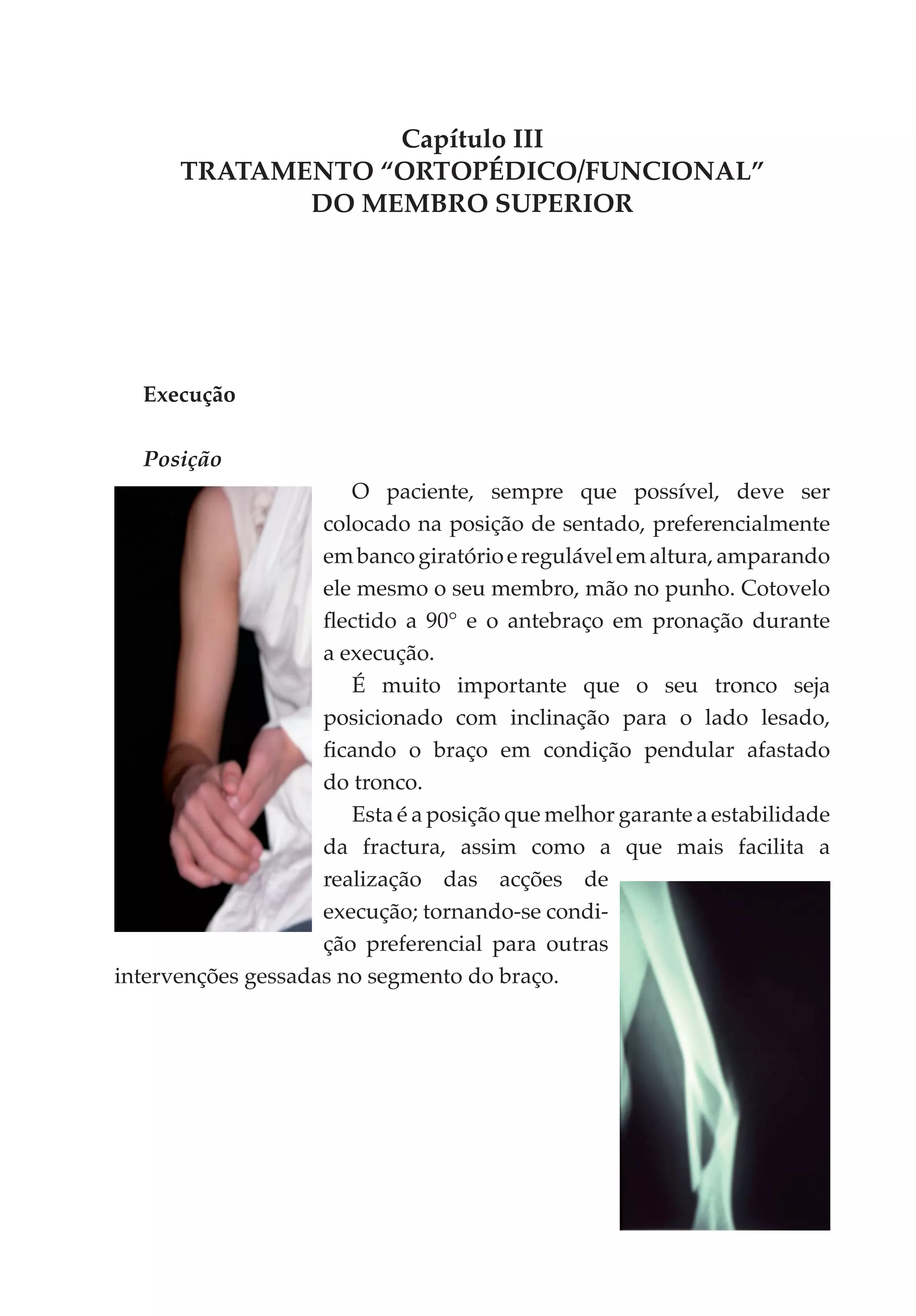 Capítulo III
      TRATAMENTO “ORTOPÉDICO/FUNCIONAL”
             DO MEMBRO SUPERIOR




  Execução

  Posição
                       O paciente, sempre que possível, deve ser
                    colocado na posição de sentado, preferencialmente
                    em banco giratório e regulável em altura, amparando
                    ele mesmo o seu membro, mão no punho. Cotovelo
                    flectido a 90° e o antebraço em pronação durante
                    a execução.
                       É muito importante que o seu tronco seja
                    posicionado com inclinação para o lado lesado,
                    ficando o braço em condição pendular afastado
                    do tronco.
                       Esta é a posição que melhor garante a estabilidade
                    da fractura, assim como a que mais facilita a
                    realização das acções de
                    execução; tornando-se condi­
                    ção preferencial para outras
intervenções gessadas no segmento do braço.
 