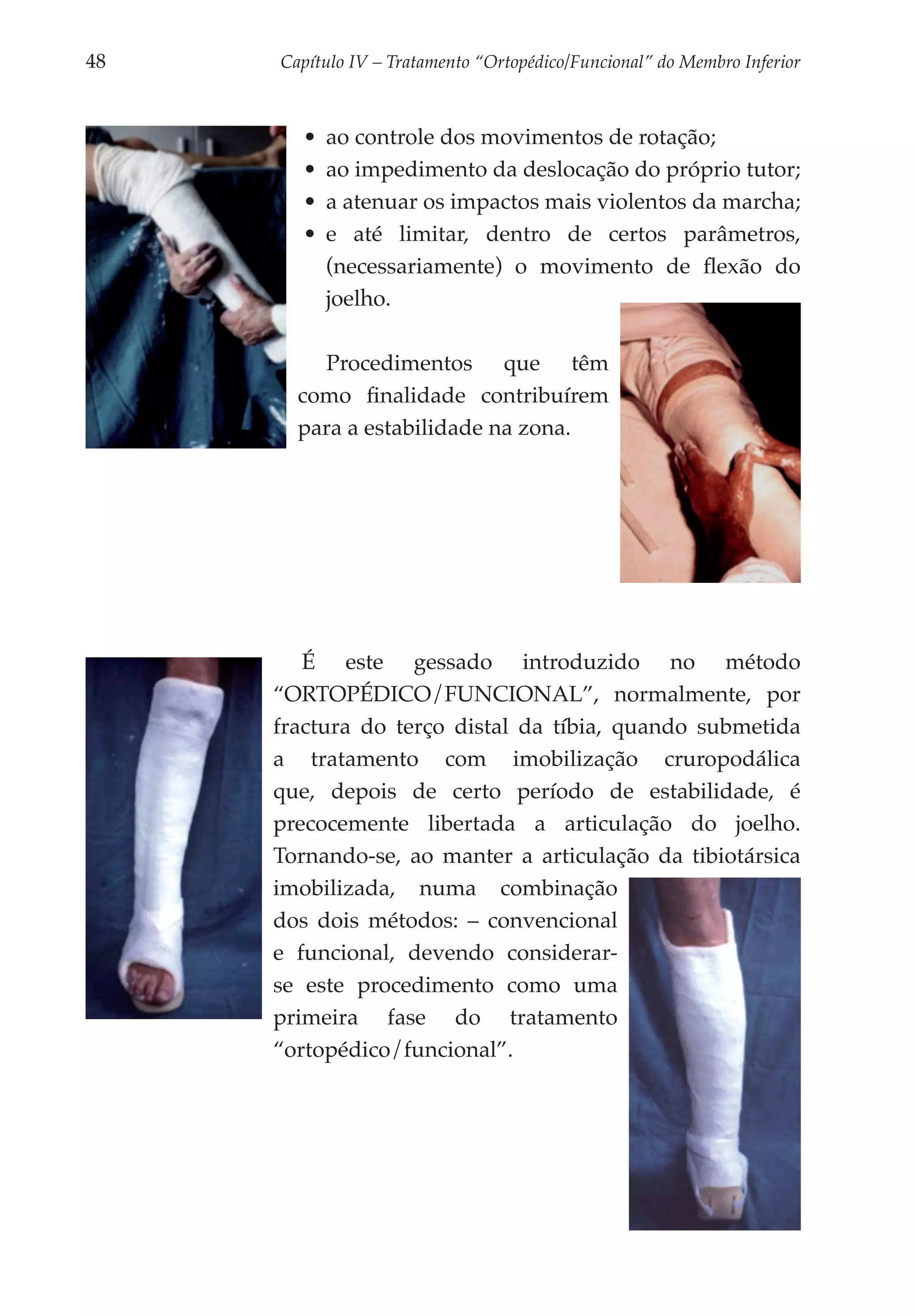 48	   Capítulo IV – Tratamento “Ortopédico/Funcional” do Membro Inferior



        •	 ao controle dos movimentos de rotação;
        •	 ao impedimento da deslocação do próprio tutor;
        •	 a atenuar os impactos mais violentos da marcha;
        •	 e até limitar, dentro de certos parâmetros,
           (necessariamente) o movimento de flexão do
           joelho.

          Procedimentos que têm
        como finalidade contribuírem
        para a estabili­ ade na zona.
                       d




         É este gessado introduzido no método
      “ORTOPÉDICO/FUNCIONAL”, normalmente, por
      fractura do terço distal da tíbia, quando submetida
      a tratamento com imobilização cruropodálica
      que, depois de certo período de estabilidade, é
      precocemente libertada a articulação do joelho.
      Tornando-se, ao manter a articulação da tibiotársica
      imobilizada, numa combinação
      dos dois métodos: – convencional
      e funcional, devendo considerar-
      se este procedimento como uma
      primeira fase do tratamento
      “ortopédico/funcional”.
 