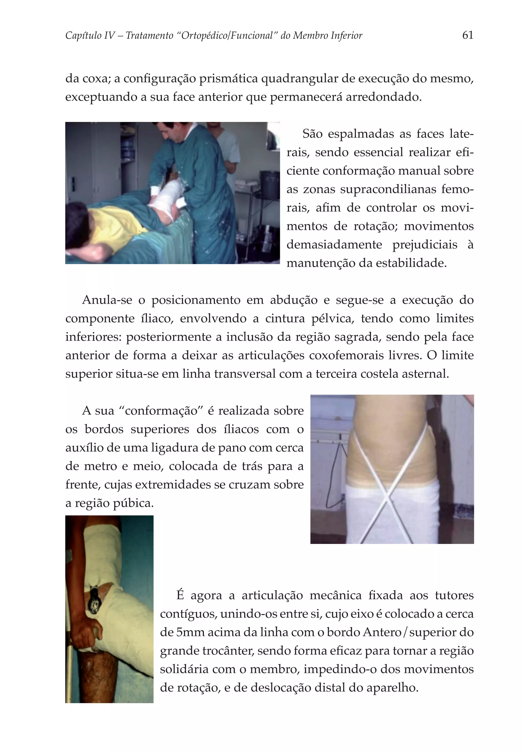 Capítulo IV – Tratamento “Ortopédico/Funcional” do Membro Inferior 	             61


da coxa; a configuração prismática quadrangular de execução do mesmo,
exceptuando a sua face anterior que permanecerá arredondado.

                                                    São espalmadas as faces late­
                                                 rais, sendo essencial realizar efi­
                                                 ciente conformação manual sobre
                                                 as zonas supracondilianas femo­
                                                 rais, afim de controlar os movi­
                                                 mentos de rotação; movimentos
                                                 demasiadamente prejudiciais à
                                                 manutenção da estabilidade.

   Anula-se o posicionamento em abdução e segue-se a execução do
componente íliaco, envolvendo a cintura pélvica, tendo como limites
inferiores: posteriormente a inclusão da região sagrada, sendo pela face
anterior de forma a deixar as articulações coxofemorais livres. O limite
superior situa-se em linha transversal com a terceira costela asternal.

   A sua “conformação” é realizada sobre
os bordos superiores dos íliacos com o
auxílio de uma ligadura de pano com cerca
de metro e meio, colocada de trás para a
frente, cujas extremidades se cruzam sobre
a região púbica.




                        É agora a articulação mecânica fixada aos tutores
                     contíguos, unindo-os entre si, cujo eixo é colocado a cerca
                     de 5mm acima da linha com o bordo Antero/superior do
                     grande trocânter, sendo forma eficaz para tornar a região
                     solidária com o membro, impedindo-o dos movimentos
                     de rotação, e de deslocação distal do aparelho.
 