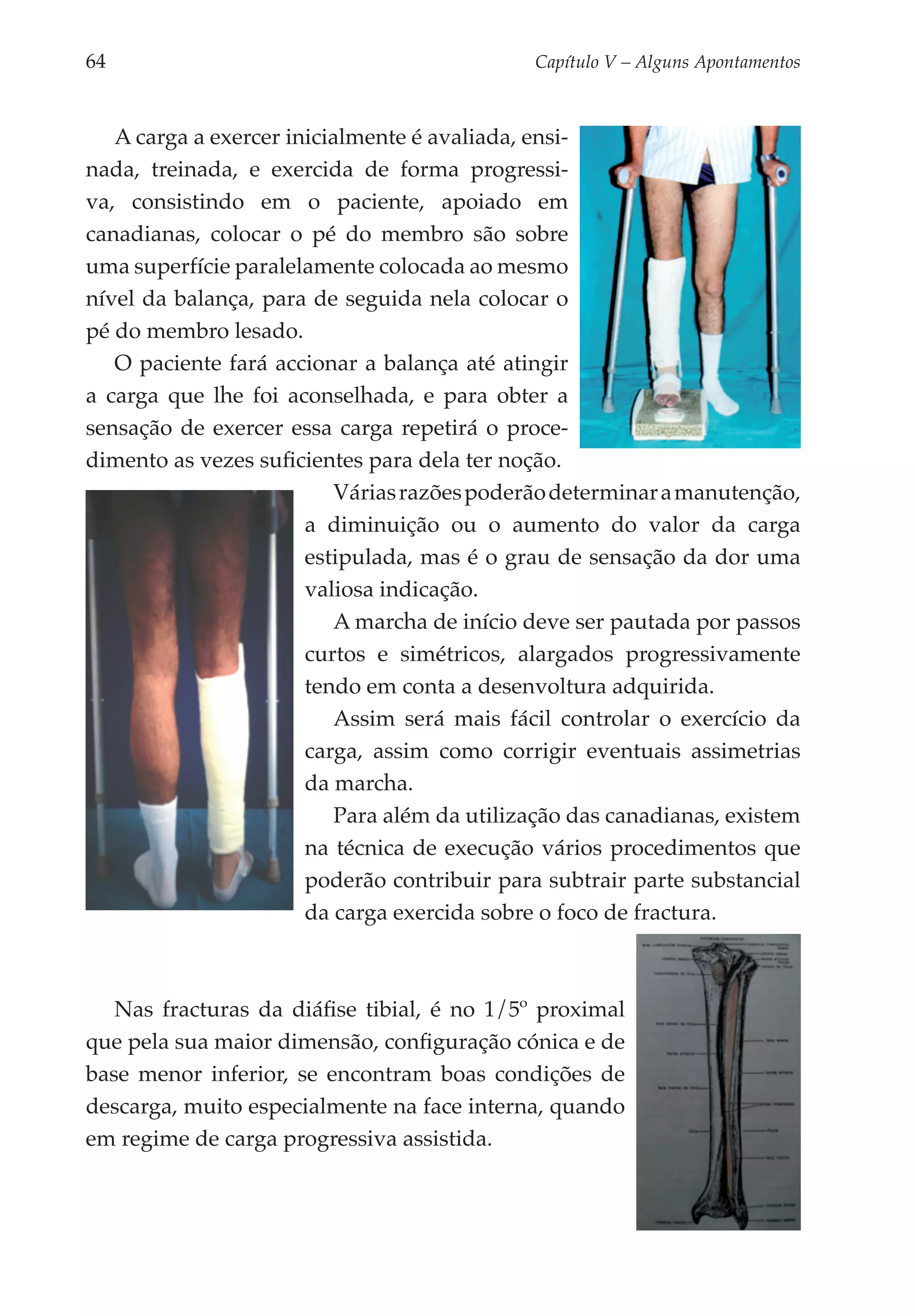 64	                                          Capítulo V – Alguns Apontamentos



   A carga a exercer inicialmente é avaliada, ensi­
nada, treinada, e exercida de forma progressi­
va, consistindo em o paciente, apoiado em
canadianas, colocar o pé do membro são sobre
uma superfície paralelamente colocada ao mesmo
nível da balança, para de seguida nela colocar o
pé do membro lesado.
   O paciente fará accionar a balança até atingir
a carga que lhe foi aconselhada, e para obter a
sensação de exercer essa carga repetirá o proce­
dimento as vezes suficientes para dela ter noção.
                           Várias razões poderão determinar a manutenção,
                       a diminuição ou o aumento do valor da carga
                       estipulada, mas é o grau de sensação da dor uma
                       valiosa indicação.
                           A marcha de início deve ser pautada por passos
                       curtos e simétricos, alargados progressivamente
                       tendo em conta a desenvoltura adquirida.
                          Assim será mais fácil controlar o exercício da
                       carga, assim como corrigir eventuais assimetrias
                       da marcha.
                          Para além da utilização das canadianas, existem
                       na técnica de execução vários procedimentos que
                       poderão contribuir para subtrair parte substancial
                       da carga exercida sobre o foco de fractura.



   Nas fracturas da diáfise tibial, é no 1/5º proximal
que pela sua maior dimensão, configuração cónica e de
base menor inferior, se encontram boas condições de
descarga, muito especialmente na face interna, quando
em regime de carga progressiva assistida.
 