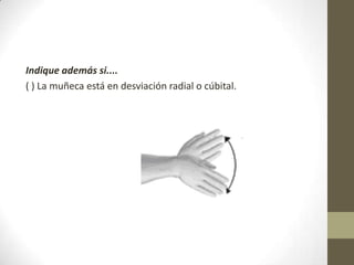 Indique además si....
( ) La muñeca está en desviación radial o cúbital.
 