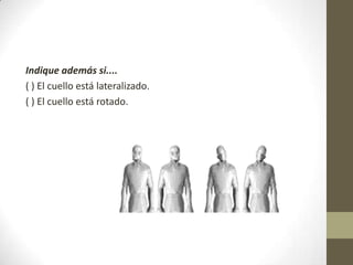 Indique además si....
( ) El cuello está lateralizado.
( ) El cuello está rotado.
 